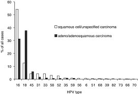 The most frequent symptom of hpv infection is actually no symptoms at all. Human Papillomavirus Types In Invasive Cervical Cancer Worldwide A Meta Analysis British Journal Of Cancer