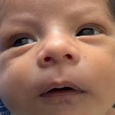 Fundraiser by Paola Arzate : Ayuda para Arian Isai