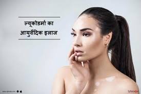 Now, let us look at some simple, ayurvedic herbal ways to manage these. Leucoderma Treatment Articles Health Tips Questions Answers Advice From Top Doctors Health Experts Lybrate