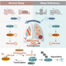 Oncogenic fatty acid oxidation senses circadian disruption in sleep-deficiency-enhanced  tumorigenesis: Cell Metabolism