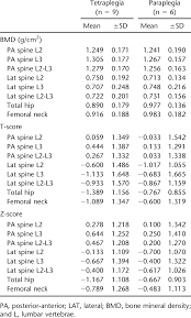 Bone Mineral Density And T And Z Scores By Level Of Spinal