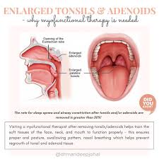 Image result for Adenodolichos