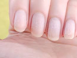 Der gelnagellack ist bestimmt lang anhaltend und effektiv. Gelnagel Selbst Entfernen In 4 Schritten Zuruck Zum Naturnagel