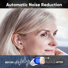 Amazon.com: Rechargeable Hearing Aids For Seniors With Noise  Canceling,Hearing Amplifier For Adults,Digital In Ear Hearing Aids, Hearing  Assist ...