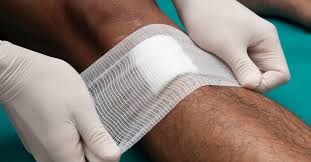 Friction blisters are very common and occur on the soles, palms and heels, where the stratum corneum is thicker (friction on thinner skin causes erosions). Open Wound Care Types Risks And Treatment