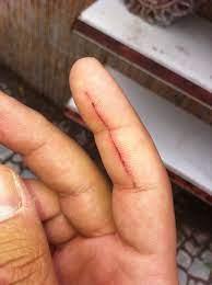 kedi tirmik izi nasil gecer kedi hayvanlari blog