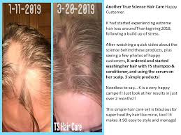 Engineered with nrf2 science, infused with clean, effective ingredients, the truescience hair care system is designed specifically for biohackers. Hair Loss Cure