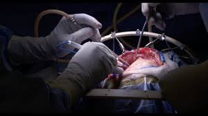 The branch of medicine that deals with the diagnosis and. Brain Surgery Craniotomy Inside The Or Youtube