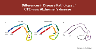 Cte is a progressive degenerative disease of the brain commonly found in people with a history of repetitive brain trauma. Researchers Discover Hidden Differences Between Pathology Of Cte And Alzheimer S Disease