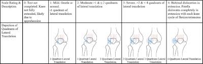 Image result for Patella Tracking Assessment