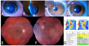 Image result for Dyschoriste transvaalensis