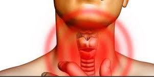 Gırtlak kanseri, nefes borusu için bir kapak işlevi gören kıkırdak parçasını da (küçük dil) etkiler. Girtlak Kanseri Bitkisel Tedavisi Kanserlemucadelem