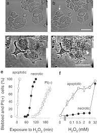 It is caused by external agents such as. Apoptotic And Necrotic Blebs In Epithelial Cells Display Similar Neck Diameters But Different Kinase Dependency Cell Death Differentiation