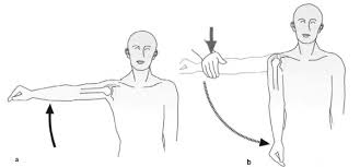 Image result for Drop Arm Test