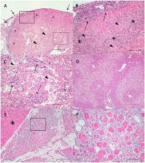 Furthermore, it noted that heart muscle inflammation was more prevalent in males than females. Plos One Heart And Skeletal Muscle Inflammation Hsmi Disease Diagnosed On A British Columbia Salmon Farm Through A Longitudinal Farm Study