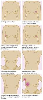 They can vary from painful, hard, and immobile to soft, painless, and easily a person should contact a doctor if they experience any symptoms that may indicate breast cancer. Early Detection Check Your Breasts