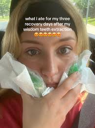 Wisdom Tooth Removal Recovery Day 3