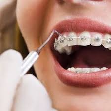 Pin On Smile