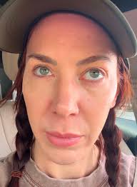 I just left the doctors office, eye infection so serious I have to do weeks  to months of antibiotics. Might not ever get back what vision I did have  which was already