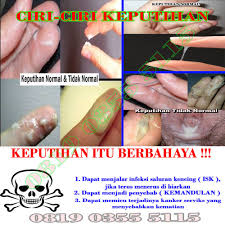 Maybe you would like to learn more about one of these? Cara Tradisional Mengatasi Keputihan Pada Wanita Obat Keputihan Ampuh