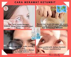 Bekas putih biasanya akan hilang secara perlahan dengan sendirinya. Facebook