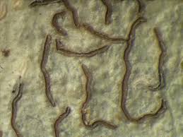 Image result for Grammitis