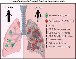 Seedy Cd8+ Trm Cells In Aging Lungs Drive Susceptibility To Pneumonia And  Sequelae | Cellular & Molecular Immunology