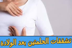 تشققات الحلمتين بعد الولادة أسبابها وعلاجها holding hands hands