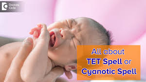 Image result for Pediatric Spell