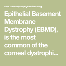 Epithelial basement membrane dystrophy is also sometimes referred to as either of the following: Epithelial Basement Membrane Dystrophy Ebmd Is The Most Common Of The Corneal Dystrophies Ii Is Also Known As Map Dot Basement Membrane Membrane Eye Health