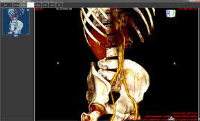 The dicom image viewer window is manually adjustable and a series of multiple images can be played in loop. Orpalis Dicom Viewer Free