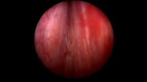 @drsalhelal's video Tweet