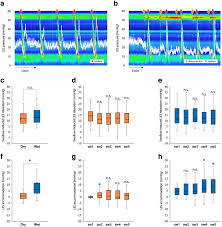 Swallows fc page on flashscore.com offers livescore, results, standings and match details (goal results. Physiological And Pathological Roles Of The Accommodation Response In Lower Esophageal Sphincter Relaxation During Wet Swallows Scientific Reports