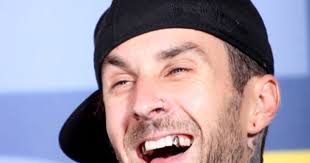 Poparzony rockman już w domu