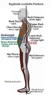 Learn now at kenhub the basic anatomy of the spine and the back muscles. Pin On Health