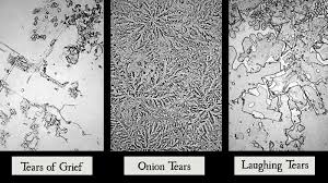 What Tears Look Like Under A Microscope Mind Journal Things Under A Microscope Microscopic Photography Types Of Humans