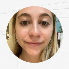 Reviewed: I Tried Aurelia Probiotic Skincare to Help My Acne