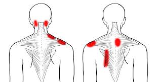 Pin On Pain In The Shoulder