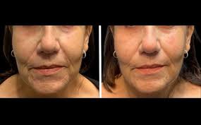 Cheryl Ann Cavanaugh, MS