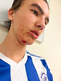 Ulykker og hendelser, Risenga