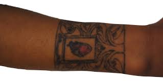 Lana and diana have been removing tattoos successfully for over 6 years with oregon aesthetics and laser tattoo removal. Before After Oregon Aesthetics Laser Tattoo Removal Oregon Aesthetics Laser Tattoo Removal