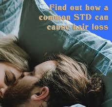Stress can be a major causative factor linked to hair loss. Belgravia Centre On Twitter This Common Std Can Cause Hair Loss For Men And Women Find Out How Https T Co 4f5g1nxamc Hairloss Hairgrowth Belgraviacentre Hairlosshelp Std Sexualhealth Hairlosshelp Hairlossblog Https T Co E5nfmkqbsk
