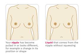 Learn more about the symptoms and diagnosis of breast cancer. Signs Of Breast Cancer How To Check Your Breasts