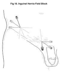 Image result for Field Block