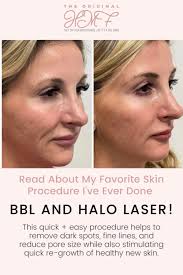 Bbl laser 2025 treatment exclusive