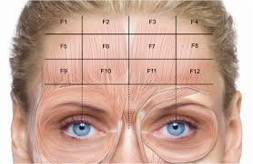 The exact injection sites depend on the size of your forehead and the distribution of frontalis muscle activity. Tailored Botulinum Toxin Type A Injections In Aesthetic Medicine Cons Ccid