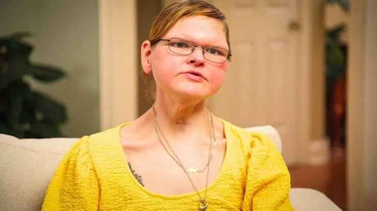 1000-Lb Sisters: Tammy Slaton's Age, Job, Medical History, Relationship  History, Instagram, & More