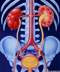 Hos de som er eldre enn 40 år, er det viktig å utelukke kreft dersom det avdekkes blod i urinen. Helsearbeiderfag Vg2 Urinveisinfeksjon Cystitt Ndla