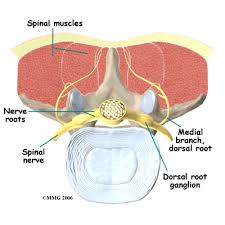 Image result for Radiofrequency Surgery