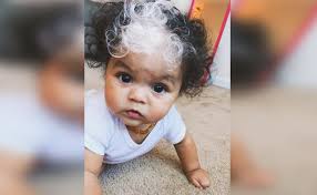 The Truth Behind This White Haired Baby Page 19 Of 21 Health Skillet Family Photo Outfits Winter Family Photo Outfits Winter Family Photos